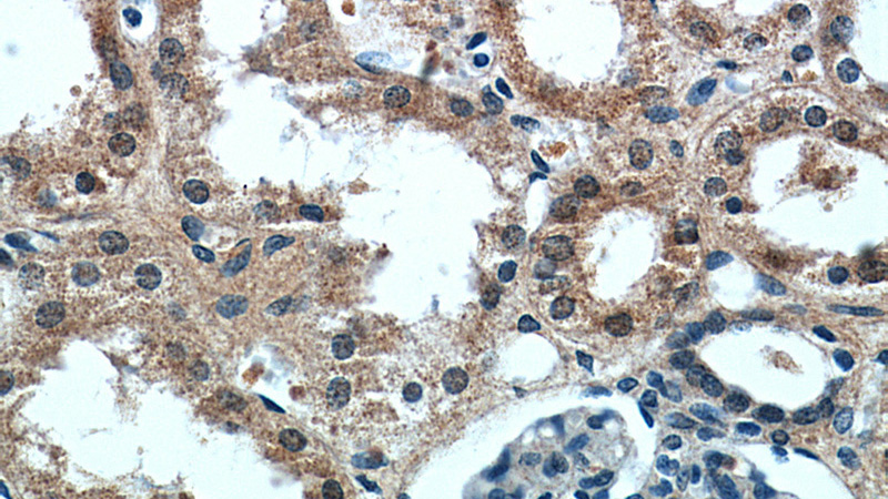 Immunohistochemical of paraffin-embedded human kidney using Catalog No:108969(CCDC25 antibody) at dilution of 1:50 (under 40x lens)