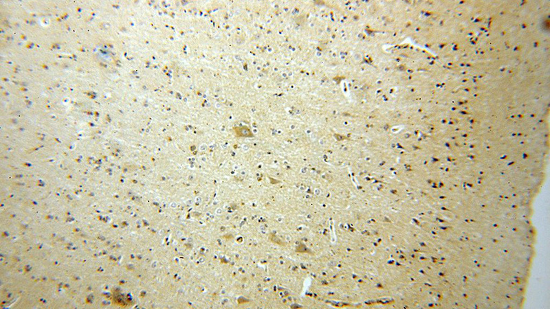 Immunohistochemical of paraffin-embedded human brain using Catalog No:110667(FIS1 antibody) at dilution of 1:25 (under 10x lens)