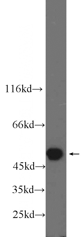 HeLa cells were subjected to SDS PAGE followed by western blot with Catalog No:114390(PSMC3 antibody) at dilution of 1:1000