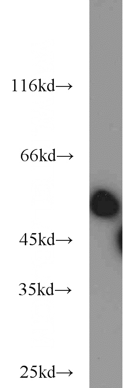 HeLa cells were subjected to SDS PAGE followed by western blot with Catalog No:114577(RCC1 antibody) at dilution of 1:1000