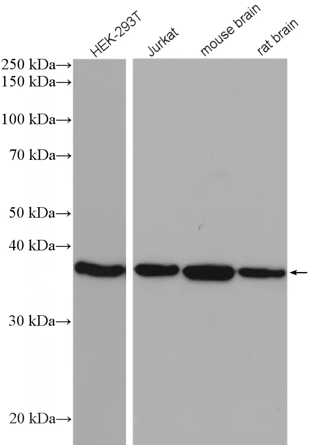 Various lysates were subjected to SDS PAGE followed by western blot with 107747 (ACOT7 antibody) at dilution of 1:5000 incubated at room temperature for 1.5 hours.