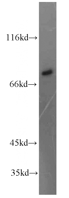mouse lung tissue were subjected to SDS PAGE followed by western blot with Catalog No:112782(MTMR12 antibody) at dilution of 1:1500