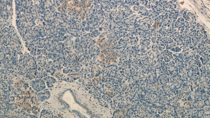 Immunohistochemistry of paraffin-embedded human pancreas tissue slide using Catalog No:116604(USP3 Antibody) at dilution of 1:50 (under 10x lens)