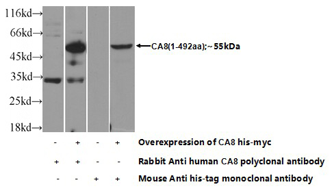 Transfected HEK-293 cells were subjected to SDS PAGE followed by western blot with Catalog No:108793(C8A Antibody) at dilution of 1:700