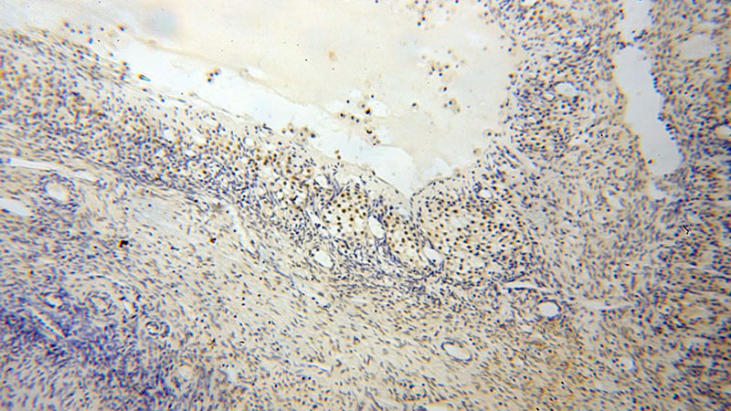 Immunohistochemical of paraffin-embedded human ovary using Catalog No:117226(BRCC3 antibody) at dilution of 1:50 (under 10x lens)