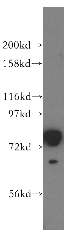 HepG2 cells were subjected to SDS PAGE followed by western blot with Catalog No:107695(ACSL1 antibody) at dilution of 1:800