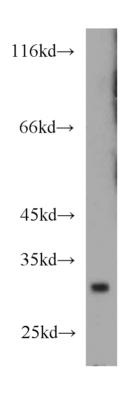 mouse colon tissue were subjected to SDS PAGE followed by western blot with Catalog No:116364(TSPAN6 antibody) at dilution of 1:1000