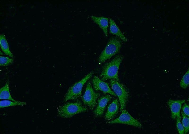 Immunofluorescent analysis of HepG2 cells using Catalog No:116862(WDR32 Antibody) at dilution of 1:50 and Alexa Fluor 488-congugated AffiniPure Goat Anti-Rabbit IgG(H+L)