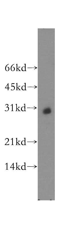 mouse brain tissue were subjected to SDS PAGE followed by western blot with Catalog No:111967(KCNIP4 antibody) at dilution of 1:500
