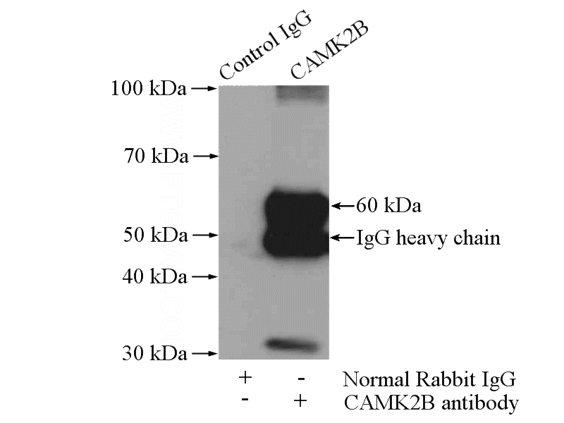 IP Result of anti-CAMK2B (IP:Catalog No:108916, 4ug; Detection:Catalog No:108916 1:1000) with mouse brain tissue lysate 4000ug.