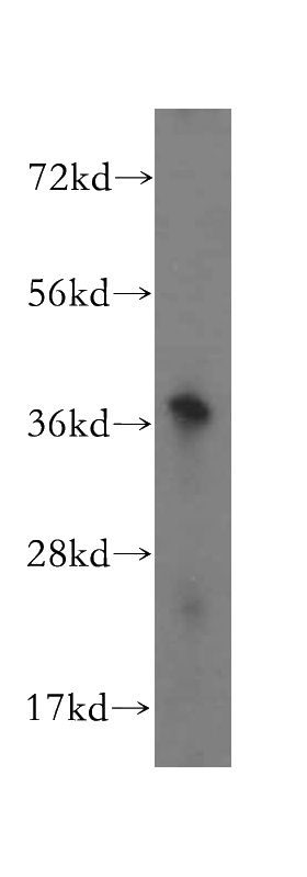 human kidney tissue were subjected to SDS PAGE followed by western blot with Catalog No:107981(ALG5 antibody) at dilution of 1:500