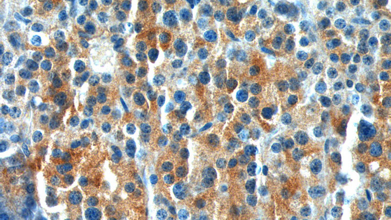 Immunohistochemistry of paraffin-embedded human pancreas tissue slide using Catalog No:111135(GPR81 Antibody) at dilution of 1:50 (under 40x lens)