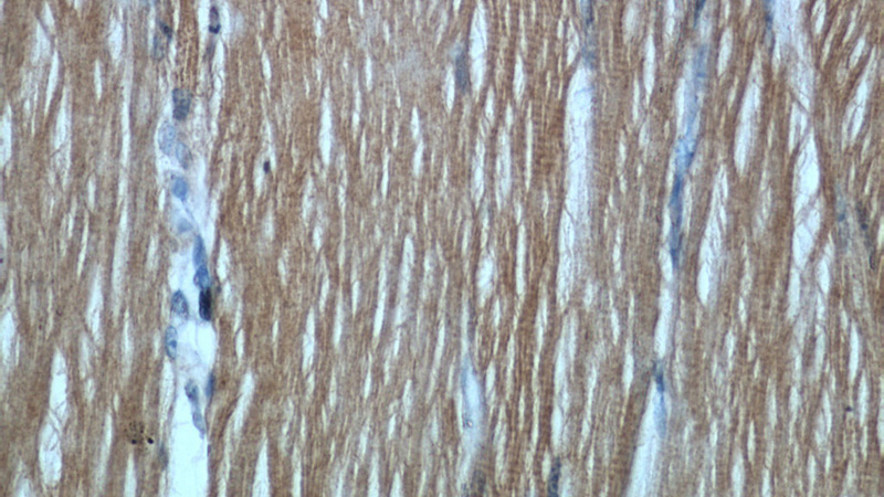 Immunohistochemical of paraffin-embedded human skeletal muscle using Catalog No:111307(HK2 antibody) at dilution of 1:50 (under 40x lens)