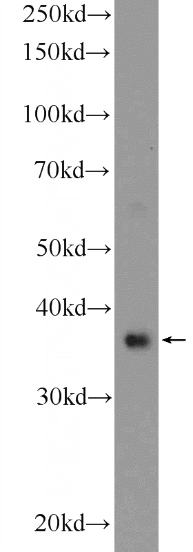 mouse testis tissue were subjected to SDS PAGE followed by western blot with Catalog No:114515(RAD51 Antibody) at dilution of 1:1000