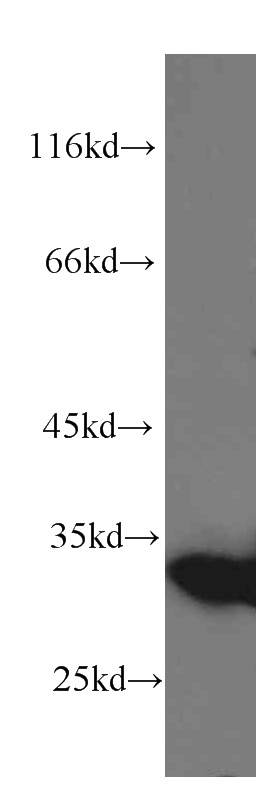 HeLa cells were subjected to SDS PAGE followed by western blot with Catalog No:107286(Galectin 3 antibody) at dilution of 1:1000