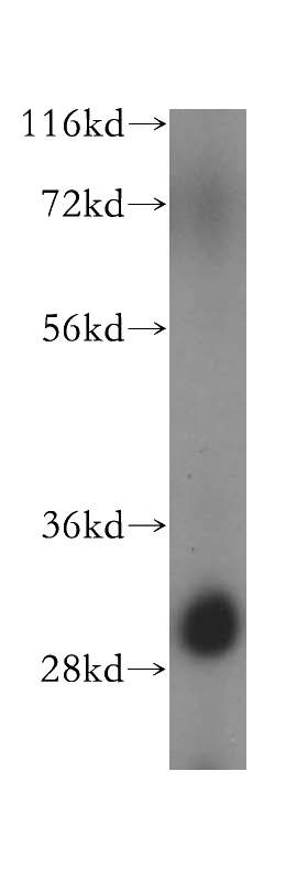 HeLa cells were subjected to SDS PAGE followed by western blot with Catalog No:114131(PPIL6 antibody) at dilution of 1:500