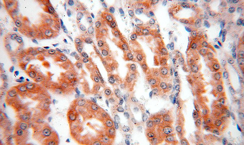 Immunohistochemical of paraffin-embedded human kidney using Catalog No:114370(PSKH2 antibody) at dilution of 1:100 (under 40x lens)