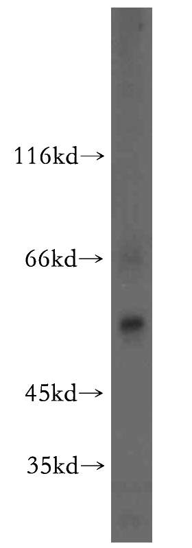 mouse brain tissue were subjected to SDS PAGE followed by western blot with Catalog No:116743(SLC32A1 antibody) at dilution of 1:1000