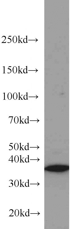 A549 cells were subjected to SDS PAGE followed by western blot with Catalog No:111440(HOXD13 antibody) at dilution of 1:800