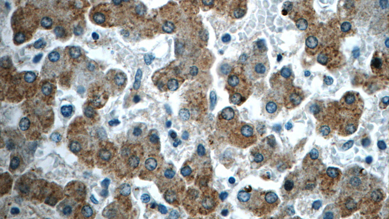 Immunohistochemistry of paraffin-embedded human liver slide using Catalog No:108979(CCDC53 Antibody) at dilution of 1:50