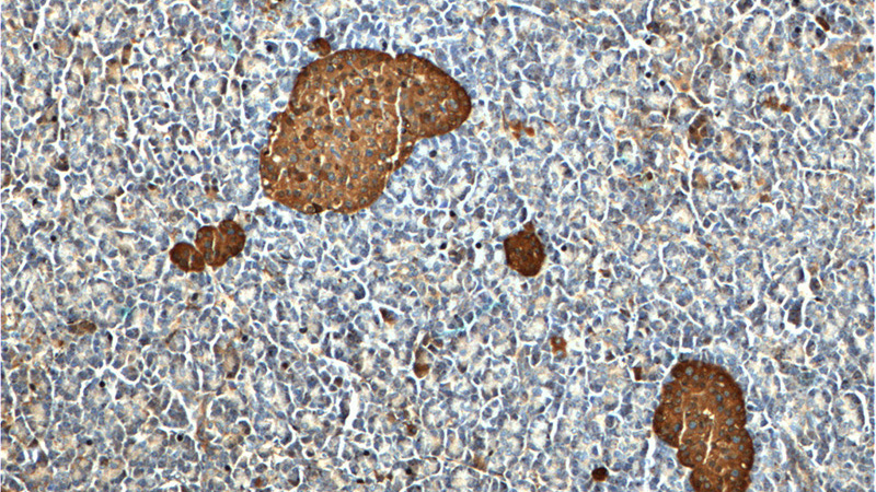 Immunohistochemistry of paraffin-embedded human pancreas tissue slide using Catalog No:115499(SST-Specific Antibody) at dilution of 1:200 (under 10x lens).
