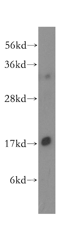 mouse thymus tissue were subjected to SDS PAGE followed by western blot with Catalog No:116518(UBE2D1 antibody) at dilution of 1:300