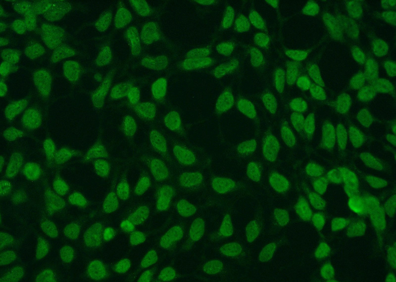 Immunofluorescent analysis of HEK-293 cells using Catalog No:115837(SUMO2/3 Antibody) at dilution of 1:50 and Alexa Fluor 488-congugated AffiniPure Goat Anti-Rabbit IgG(H+L)