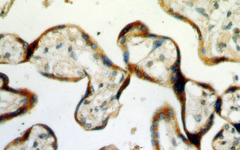 Immunohistochemical of paraffin-embedded human placenta using Catalog No:112360(LTBP2 antibody) at dilution of 1:50 (under 40x lens)