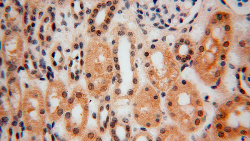 Immunohistochemical of paraffin-embedded human kidney using Catalog No:115356(SLFNL1 antibody) at dilution of 1:100 (under 40x lens)