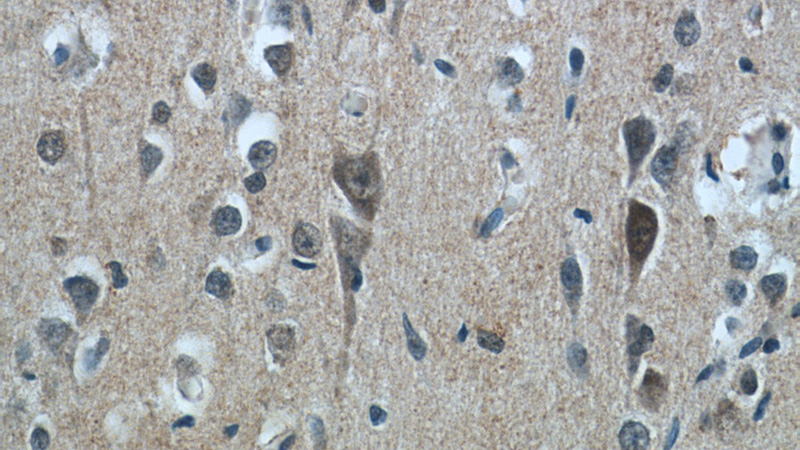 Immunohistochemistry of paraffin-embedded human brain tissue slide using Catalog No:114104(PPP2R3C Antibody) at dilution of 1:50 (under 40x lens)