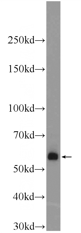 human skeletal muscle tissue were subjected to SDS PAGE followed by western blot with Catalog No:117202(BMPR1A Antibody) at dilution of 1:1000