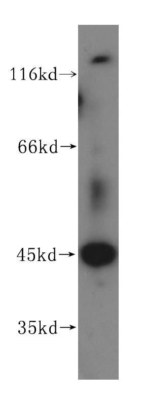 HeLa cells were subjected to SDS PAGE followed by western blot with Catalog No:116133(TIMM44 antibody) at dilution of 1:500