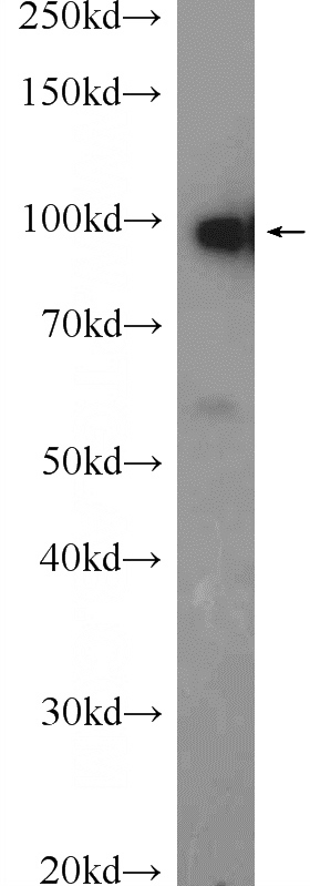mouse testis tissue were subjected to SDS PAGE followed by western blot with Catalog No:109430(CNNM4 Antibody) at dilution of 1:600