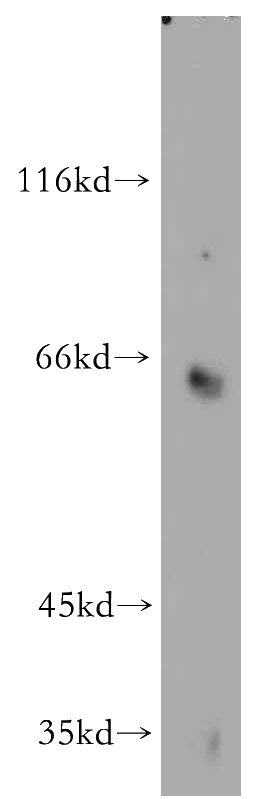 mouse brain tissue were subjected to SDS PAGE followed by western blot with Catalog No:116165(Toca 1 antibody) at dilution of 1:300