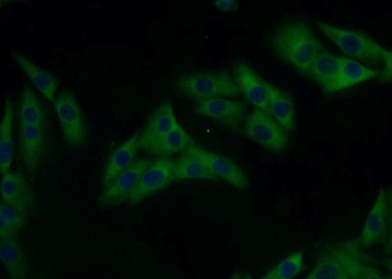 Immunofluorescent analysis of A375 cells using Catalog No:112382(MAGEA6 Antibody) at dilution of 1:25 and Alexa Fluor 488-congugated AffiniPure Goat Anti-Rabbit IgG(H+L)