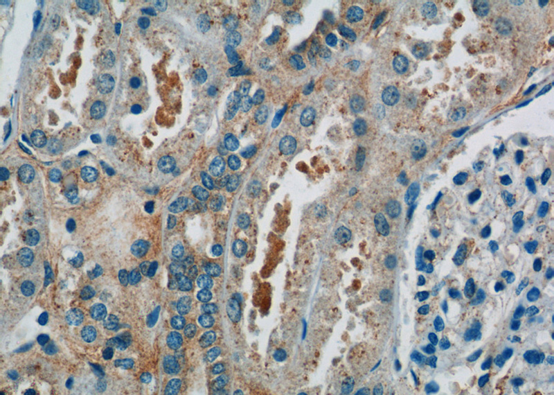Immunohistochemistry of paraffin-embedded human kidney tissue slide using Catalog No:111358(hIST1 Antibody) at dilution of 1:50 (under 40x lens)