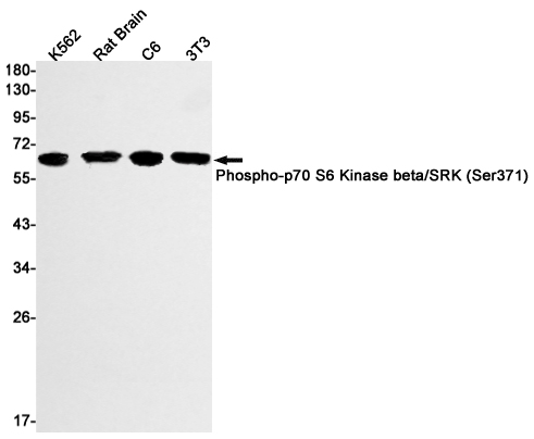 Western blot detection of Phospho-p70 S6 Kinase beta/SRK (Ser371) in K562,Rat Brain,C6,3T3 cell lysates using Phospho-p70 S6 Kinase beta/SRK (Ser371) Rabbit mAb(1:1000 diluted).Predicted band size:54kDa.Observed band size:60kDa.