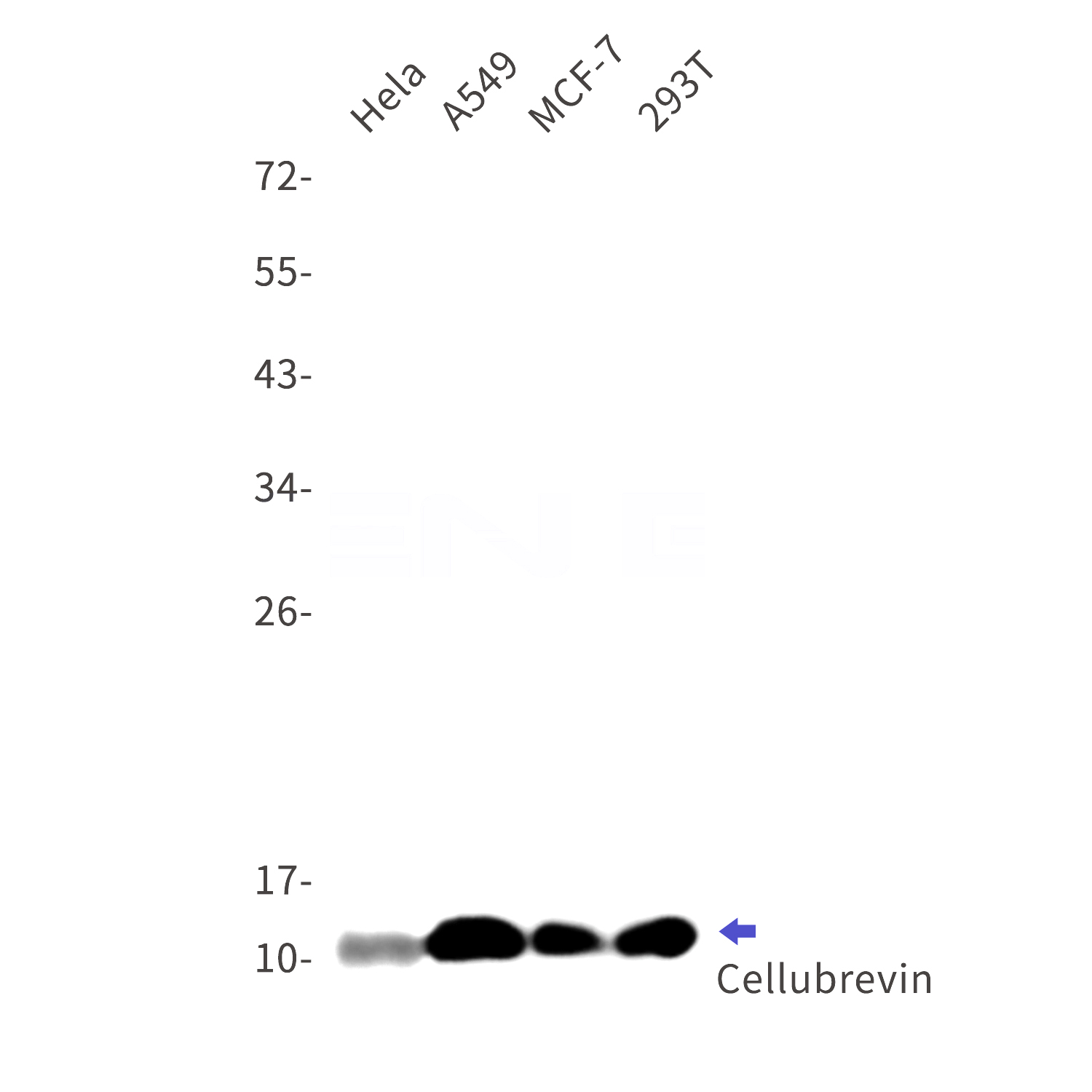 Western blot detection of Cellubrevin in Hela,A549,MCF-7,293T cell lysates using Cellubrevin Rabbit mAb(1:1000 diluted).Predicted band size:11kDa.Observed band size:11kDa.