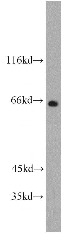 MCF7 cells were subjected to SDS PAGE followed by western blot with Catalog No:110733(FMR1NB antibody) at dilution of 1:1000