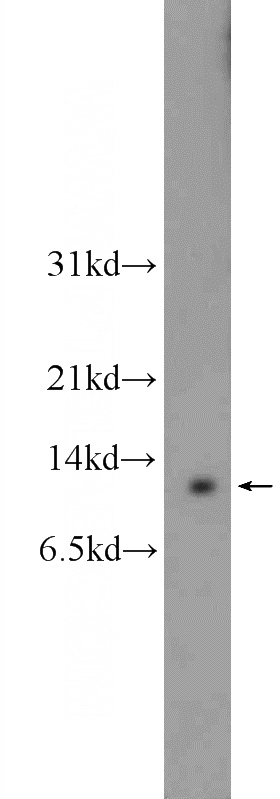 mouse lung tissue were subjected to SDS PAGE followed by western blot with Catalog No:111524(HOPX Antibody) at dilution of 1:600