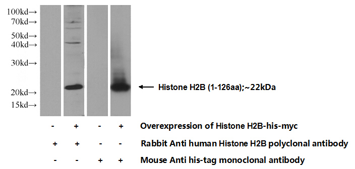 Transfected HEK-293 cells were subjected to SDS PAGE followed by western blot with Catalog No:111406(Histone H2B Antibody) at dilution of 1:1000