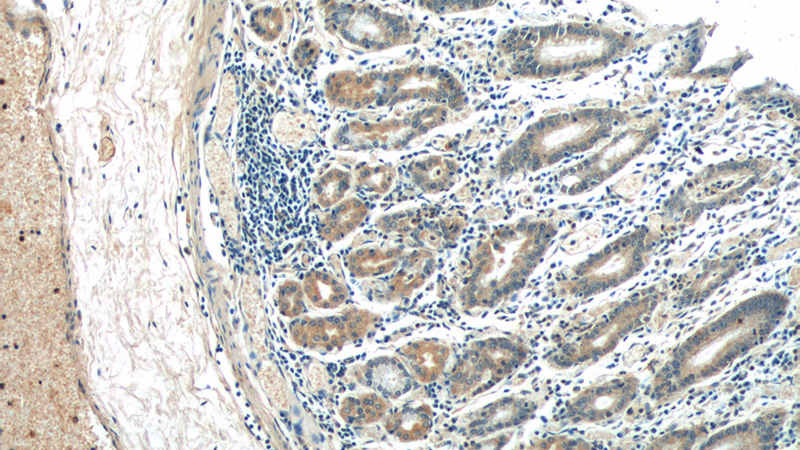 Immunohistochemistry of paraffin-embedded human stomach tissue slide using Catalog No:117083(AZI2 Antibody) at dilution of 1:50 (under 10x lens)