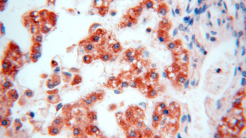 Immunohistochemical of paraffin-embedded human liver using Catalog No:111662(IL15RA antibody) at dilution of 1:50 (under 40x lens)
