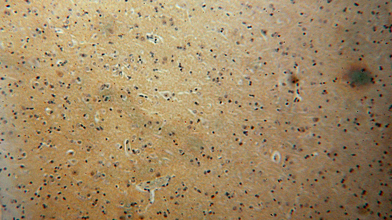 Immunohistochemical of paraffin-embedded human brain using Catalog No:114206(PRMT3 antibody) at dilution of 1:100 (under 10x lens)