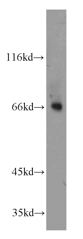 human brain tissue were subjected to SDS PAGE followed by western blot with Catalog No:112739(MOXD1 antibody) at dilution of 1:100
