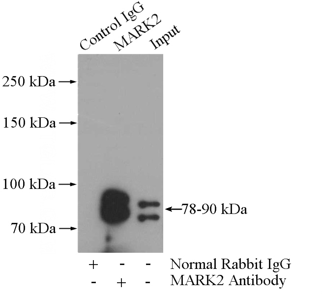 IP Result of anti-MARK2 (IP:Catalog No:112479, 4ug; Detection:Catalog No:112479 1:1000) with rat brain tissue lysate 4000ug.