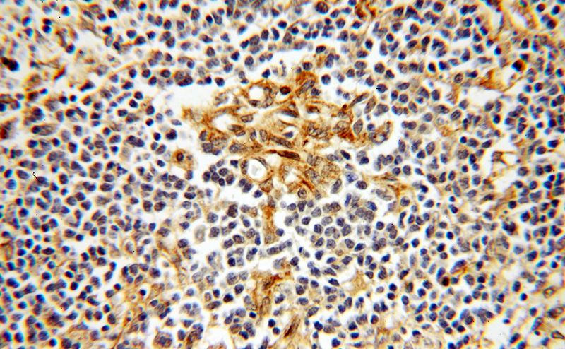 Immunohistochemical of paraffin-embedded human spleen using Catalog No:116211(TPPP antibody) at dilution of 1:100 (under 40x lens)