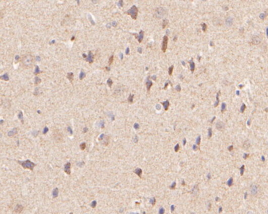 Fig3:; Immunohistochemical analysis of paraffin-embedded rat brain tissue using anti-P2RX5 antibody. The section was pre-treated using heat mediated antigen retrieval with Tris-EDTA buffer (pH 8.0-8.4) for 20 minutes.The tissues were blocked in 5% BSA for 30 minutes at room temperature, washed with ddH; 2; O and PBS, and then probed with the primary antibody ( 1/50) for 30 minutes at room temperature. The detection was performed using an HRP conjugated compact polymer system. DAB was used as the chromogen. Tissues were counterstained with hematoxylin and mounted with DPX.