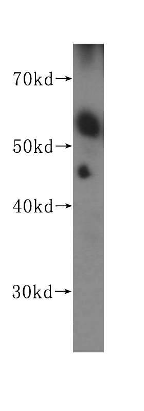 human kidney tissue were subjected to SDS PAGE followed by western blot with Catalog No:114186(PSEN1-Specific antibody) at dilution of 1:600