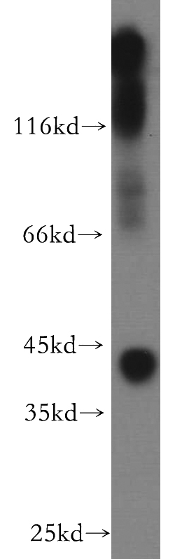 mouse brain tissue were subjected to SDS PAGE followed by western blot with Catalog No:112064(KCNJ10 antibody) at dilution of 1:500